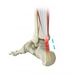 foot ankle procedure 